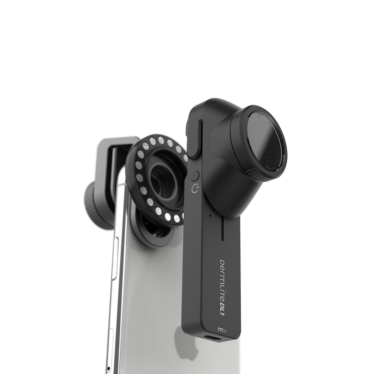 DermLite DL1 Pocket Dermatoscope