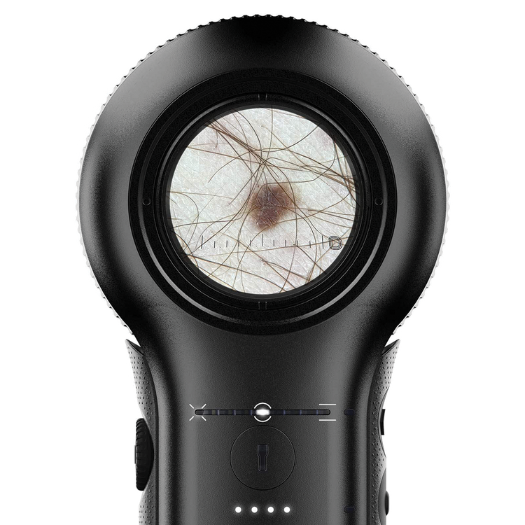 DermLite DL5 Hand Held Variable Polarising & UV Dermatoscope