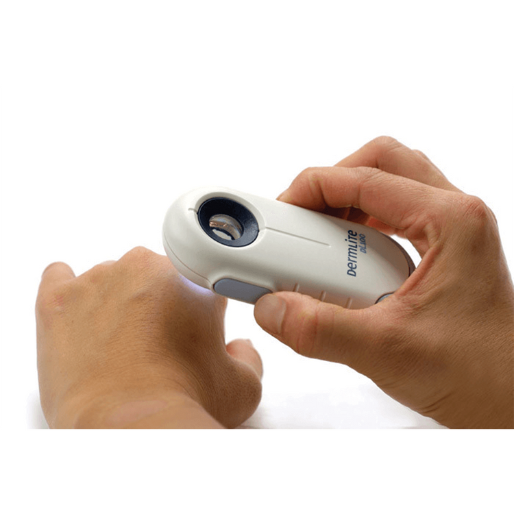 DermLite DL100 Pocket Dermatoscope