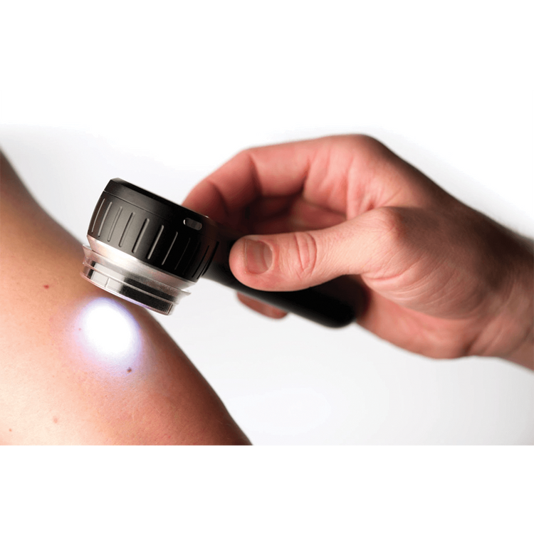 DermLite DL4W Pocket Dermatoscope