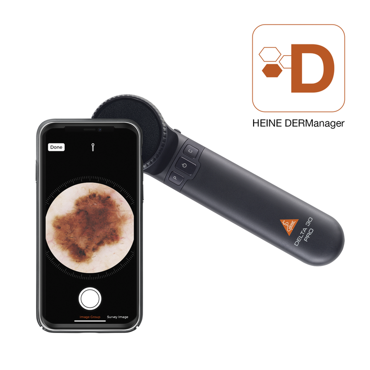 Heine Delta 30 Pro Dermatoscope