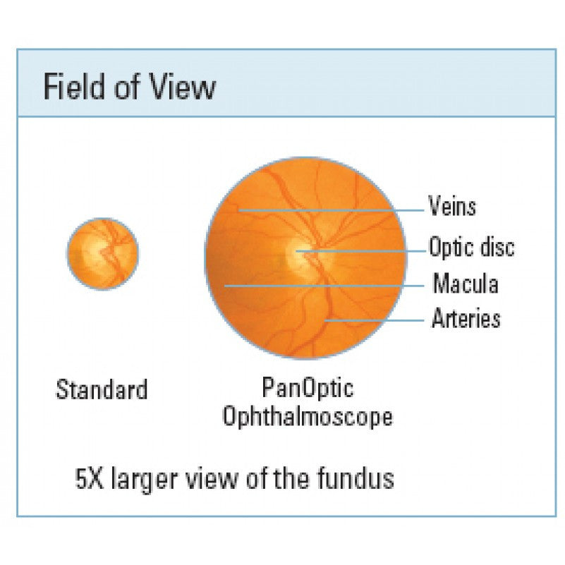 Direct Ophthalmoscope View